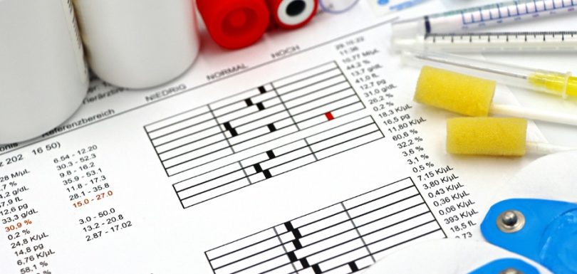 Blood test results with collection tubes and medical testing supplies